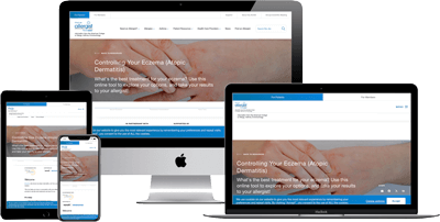 A website about controlling eczema is displayed on a smartphone, tablet, laptop, and desktop computer, showing responsive design across different devices. The screen features images of hands and an informational headline.