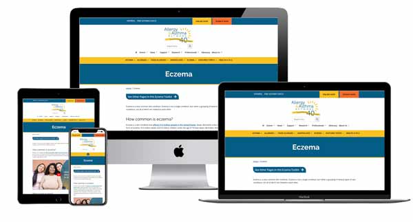 Un sitio web sobre el eczema se muestra en un monitor de escritorio, una computadora portátil, una tableta y un teléfono inteligente, mostrando su diseño adaptativo en diferentes dispositivos.