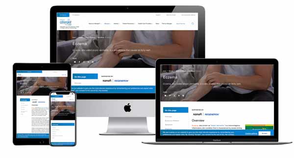 Un sitio web médico sobre el eczema se muestra en una tableta, un teléfono inteligente, una computadora de escritorio y una computadora portátil, mostrando su diseño adaptable en múltiples dispositivos.