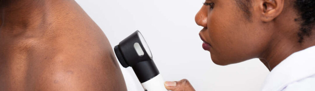 A healthcare professional examines a person’s back with a dermatoscope, closely inspecting the skin for abnormalities. Both individuals have dark skin tones and are shown against a plain background.