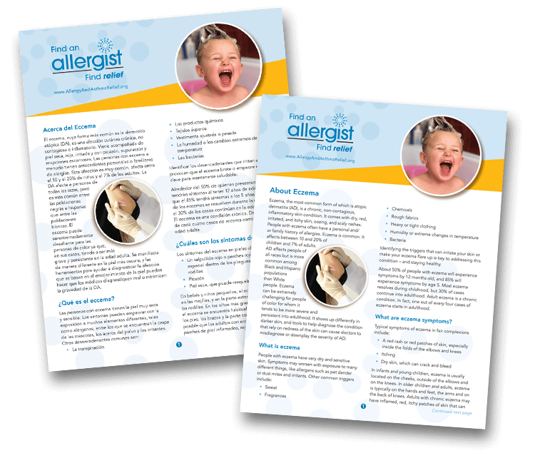 Two informational flyers about eczema from "Find an Allergist." Each features a child scratching their skin, text in English and Spanish, and a round image of another child with irritated skin. The flyers provide symptoms and relief tips.