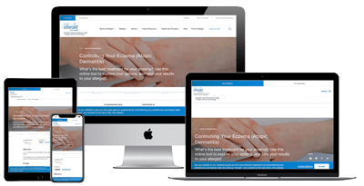 A website about controlling eczema is displayed on a smartphone, tablet, laptop, and desktop monitor, showing the site’s responsive design and a close-up image of hands affected by eczema on each screen.